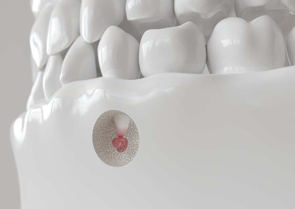 dentist in Rancho Cucamonga