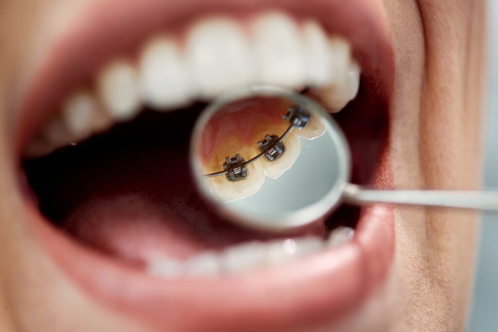 dentist in Rancho Cucamonga