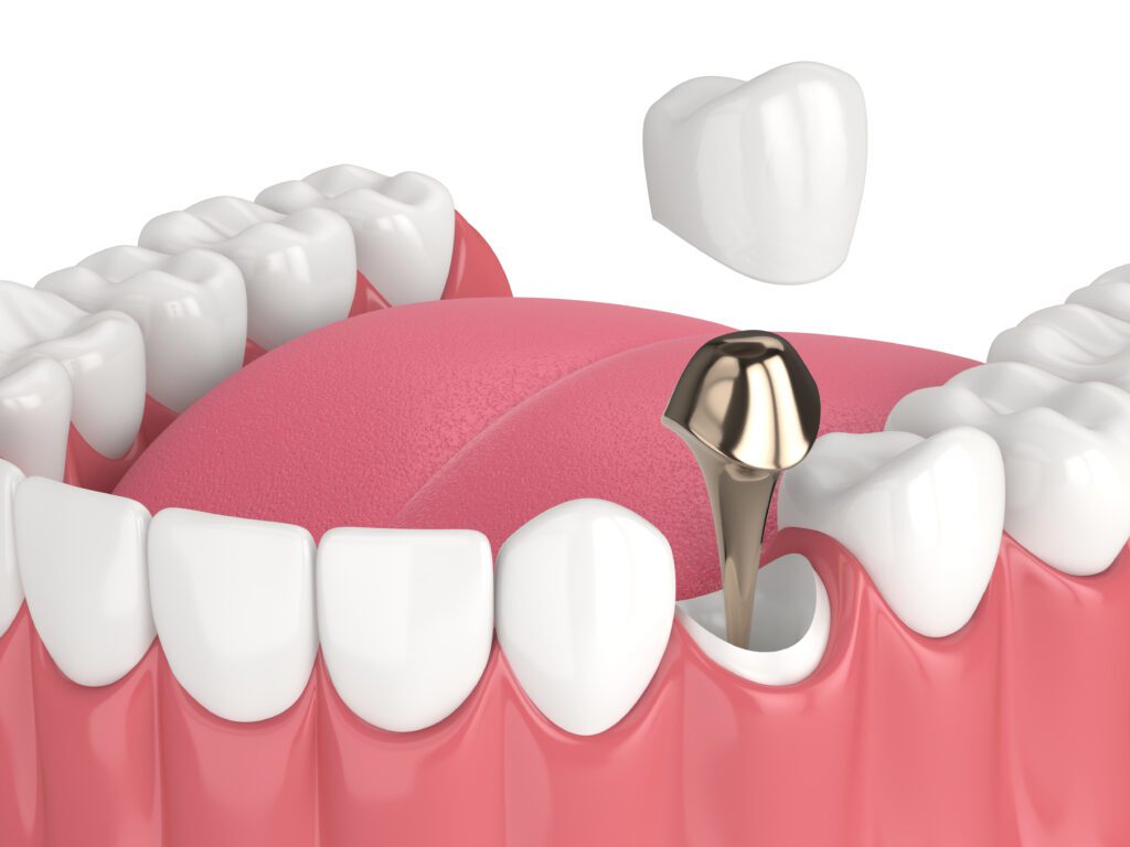 dentist in Rancho Cucamonga