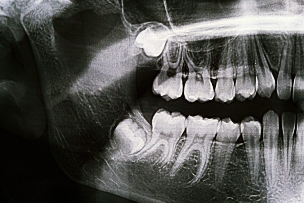 dentist in Rancho Cucamonga